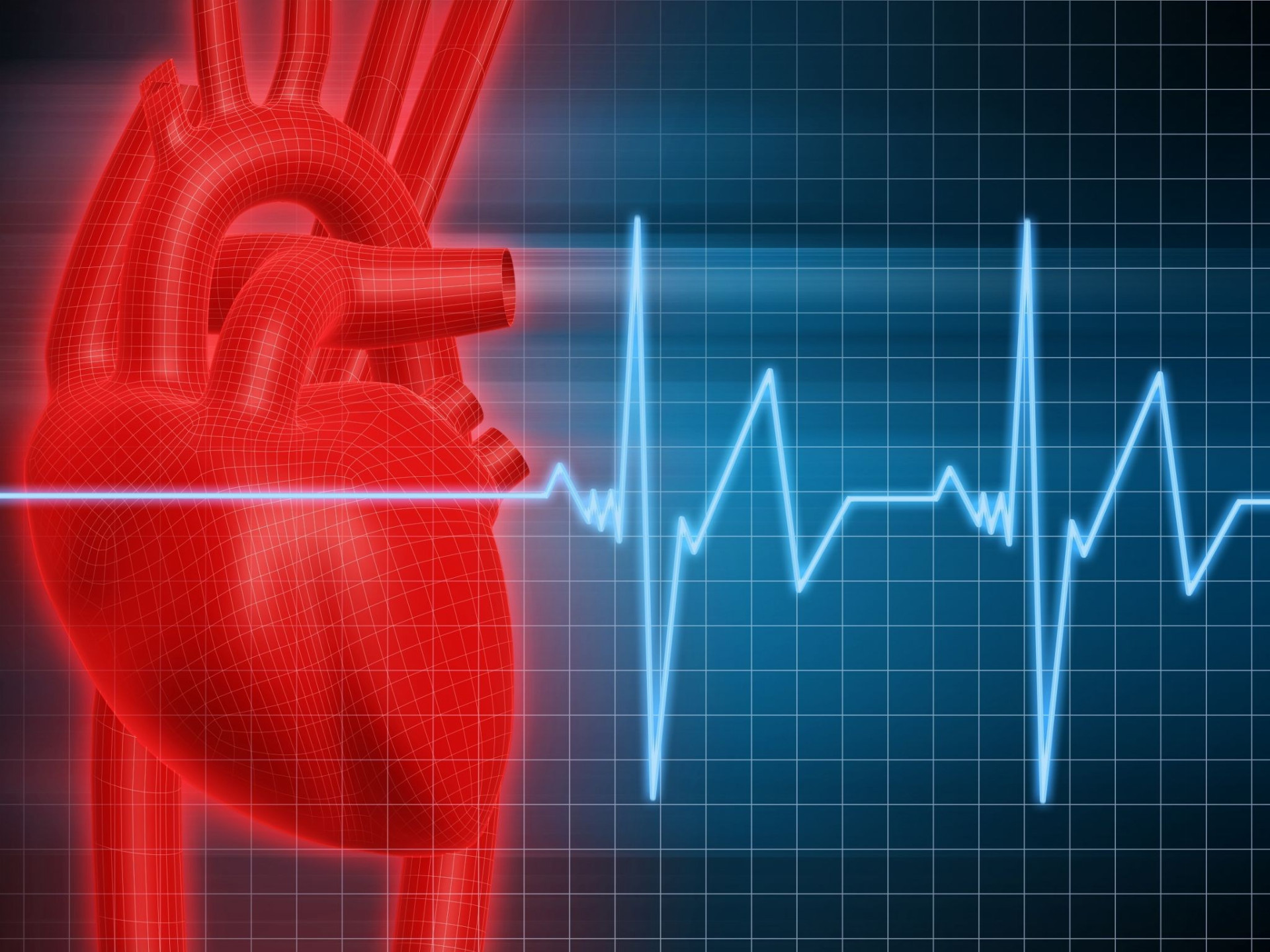 Infarkt
Pri infarkte sa množstvo krvi vtekajúcej do srdcového svalu výrazne obmedzí alebo dokonca až zastaví. Môže to spôsobiť tepna upchatá krvnou zrazeninou, alebo keď sa kŕčovito stiahne. 

Ak sa prívod krvi a kyslíka preruší na dlhšie ako na pár minút, bunky srdcového svalu sa trvalo poškodia a začnú odumierať. Niektoré srdcové príhody vznikajú veľmi dramaticky – sú náhle a prudké, človek pri nich lapá po dychu, s rukou pritisnutou na srdce padá na zem. Oveľa častejšie sa však infarkt začína pomaly, nevýraznou bolesťou či nevoľnosťou. K príznakom patrí nepríjemný pocit v oblasti hrudníka, ktorý trvá viac minút. Možno ho pociťovať ako nepríjemný tlak, zvieranie, pálenie, tupú bolesť na hrudi alebo pocit plnosti. Bolesti či nepríjemný pocit môžu však vyžarovať aj do hornej polovice tela, najčastejšie do ľavej ruky, do chrbta, šije, čeľuste alebo aj do oblasti žalúdka. Ďalším varovaním je skrátenie dychu alebo dýchavičnosť, priebeh akútneho infarktu môže sprevádzať studený pot, žalúdočná nevoľnosť, strata rovnováhy alebo až bezvedomie. Ženy pri infarkte vo všeobecnosti častejšie ako muži pociťujú bolesť alebo nepríjemný tlak v hrudi. Majú aj častejšiu skúsenosť než muži s niektorými ďalšími bežnými symptómami, čiastočným skrátením dychu, žalúdočnou nevoľnosťou, zvracaním, bolesťou chrbta alebo čeľuste. Na druhej strane ženy s výraznou nadváhou, alebo obezitou, nezriedka nemajú žiadnu bolesť, skôr menšiu nevoľnosť, takže vôbec lekársku pomoc nevyhľadávajú. Ďalšou skupinou chorých sú osoby s cukrovkou, ktoré pri akútnom infarkte myokardu nemusia pociťovať žiadne varovné signály (v dôsledku poškodenia nervových zakončení). Čo robiť? Základom je čím skôr privolať pomoc zdravotníkov. Ak ste s niekým, kto má pravdepodobne príznaky infarktu, očakávajte, že bude situáciu zľahčovať – odmietanie je bežné. Neakceptujte „pokazený žalúdok“ a zavolajte záchranku.