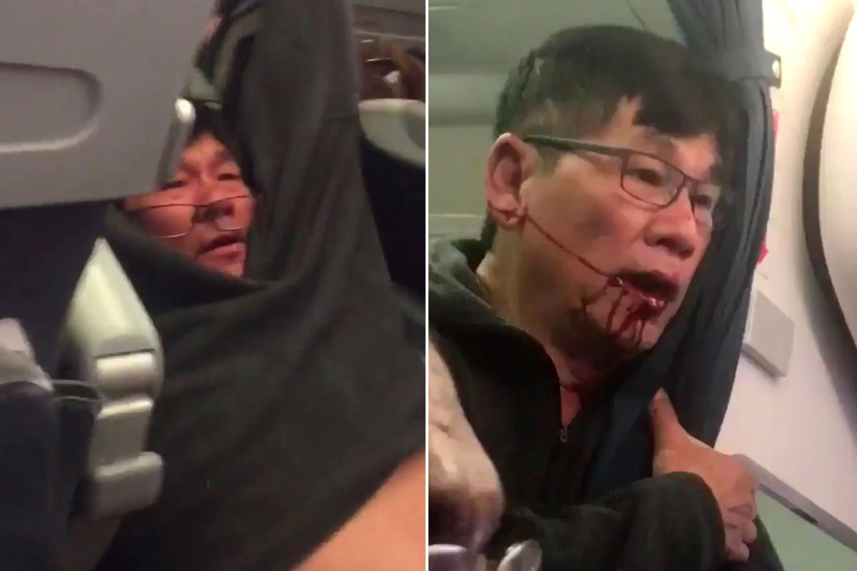united airlines incident