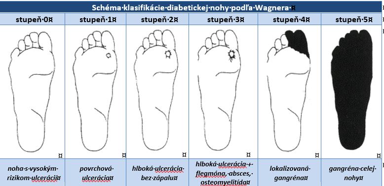 Klasifikácia diabetickej nohy