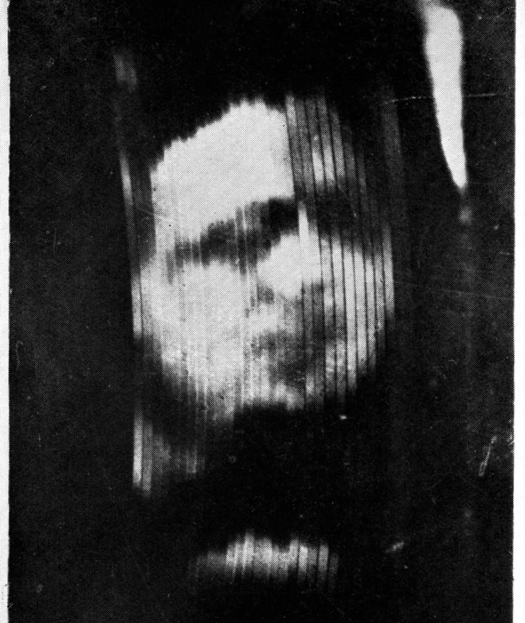 Obraz na prvom Bairdovom televíznom prijímači bol slabý a rozmazaný. Takto sa na ňom zobrazovala ľudská tvár.