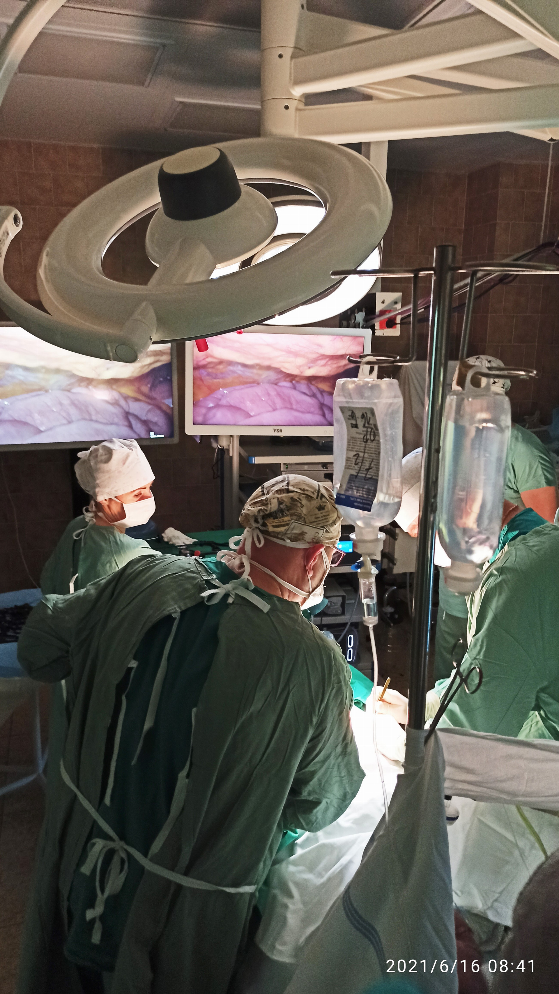 operácia laparoskopickou vežou vo FNsP Skalica