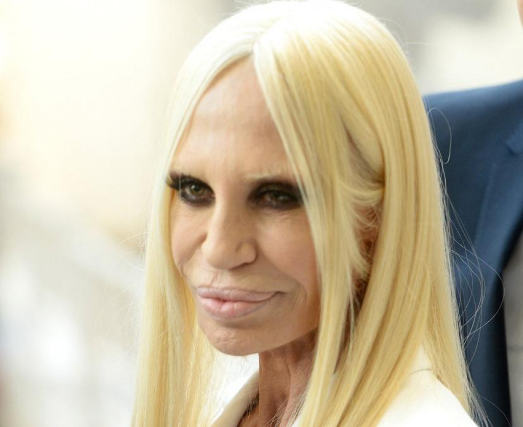 V roku 2014 vyzerala Donatella najhoršie.