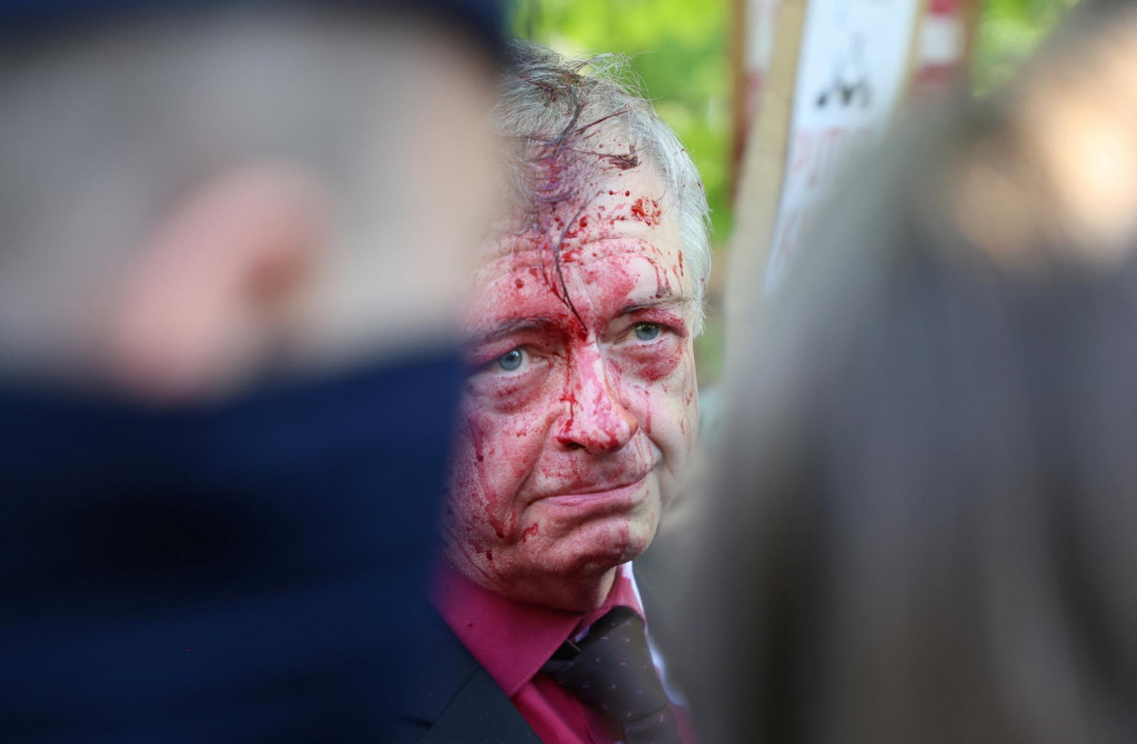 &lt;p&gt;Ruský veľvyslanec v Poľsku Sergej Andrejev poliaty červenou farbou. FOTO: REUTERS&lt;/p&gt;