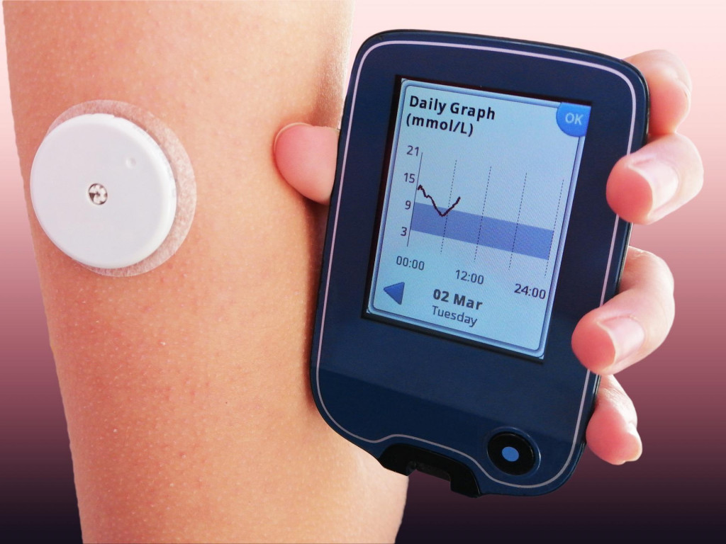 Aj diabetici na Slovensku už majú od apríla dostupný senzor FreeStyle Libre, o ktorý tak veľmi bojovali. Zdravotné poisťovne ho preplácajú len určitej skupine pacientov.