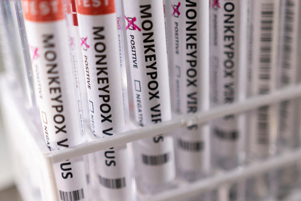 FILE PHOTO: Test tubes labelled ”Monkeypox virus positive” are seen in this illustration taken May 22, 2022. REUTERS/Dado Ruvic/Illustration/File Photo