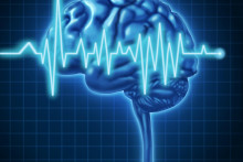 &lt;p&gt;Human Brain ECG Health monitoring of the electrical signals that cause seizures and other problems in the human mind and charting the cognitive mental function of the intelligence of the anatomy of the body.&lt;/p&gt;