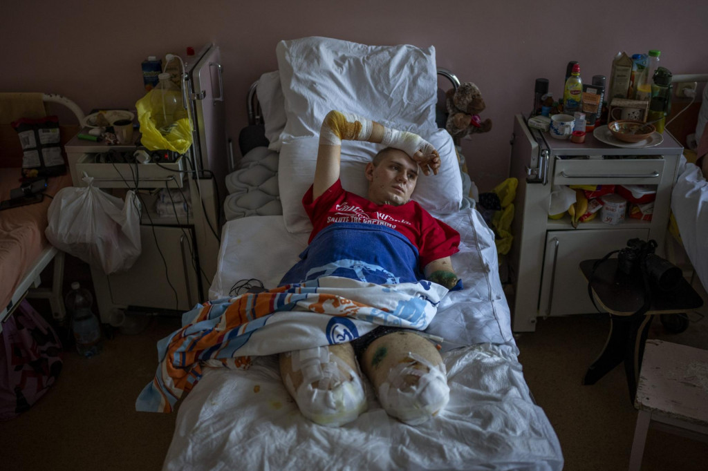 &lt;p&gt;Anton Gladun v nemocničnej izbe v meste Čerkasy v strednej časti Ukrajiny. Anton, vojenský lekár, ktorý pôsobil na frontovej línii na východe Ukrajiny, prišiel o obe nohy a ľavú ruku koncom marca po výbuchu míny. FOTO: TASR/AP&lt;/p&gt;