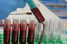 Laborantka strieka vzorku krvi do skúmavky v laboratóriu. FOTO: TASR/AP