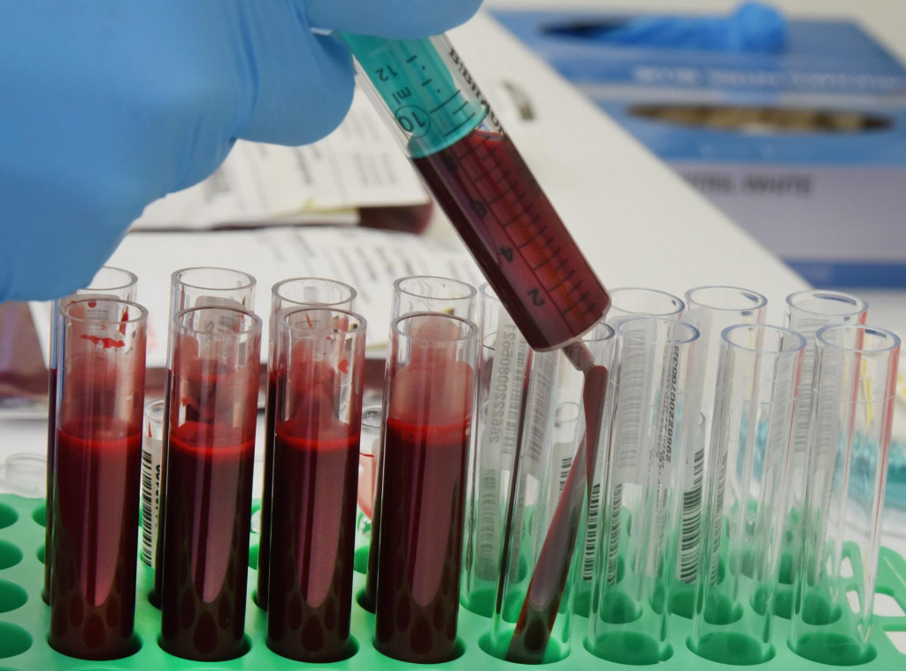 Laborantka strieka vzorku krvi do skúmavky v laboratóriu. FOTO: TASR/AP