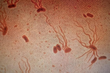 Baktéria S Typhi.