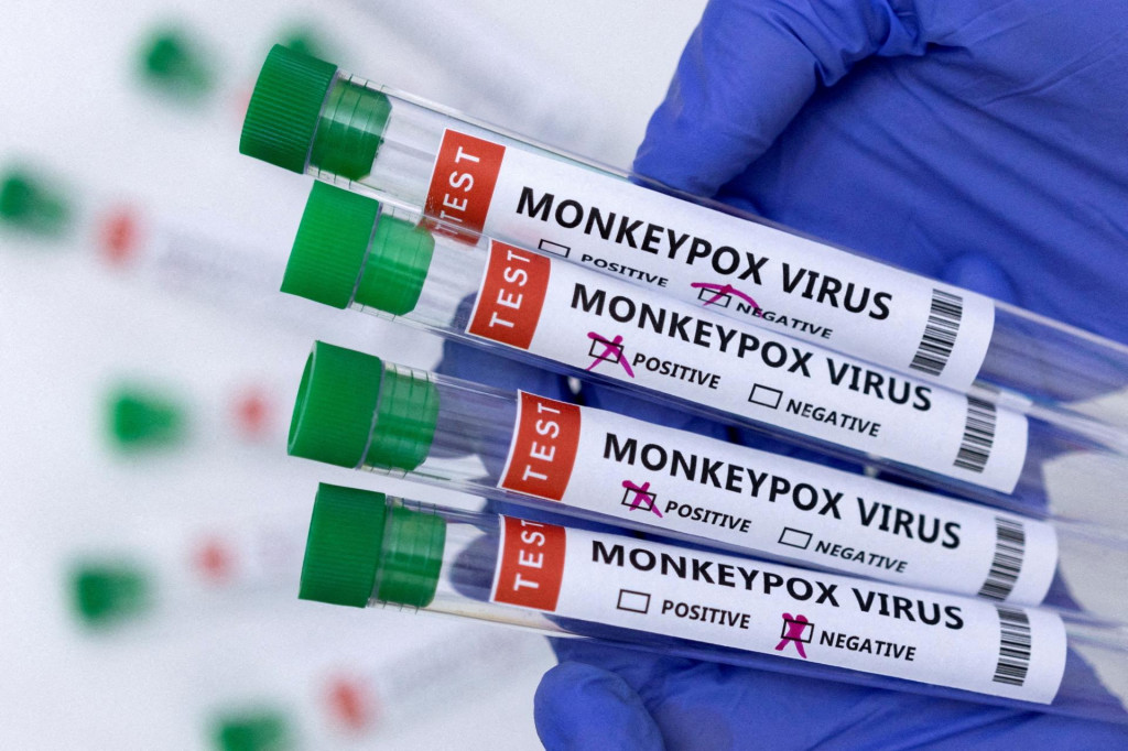 Vírus opičích kiahní. FOTO: Reuters