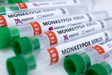 &lt;p&gt;Skúmavky s nápisom vírus opičích kiahní. FOTO: Reuters&lt;/p&gt;