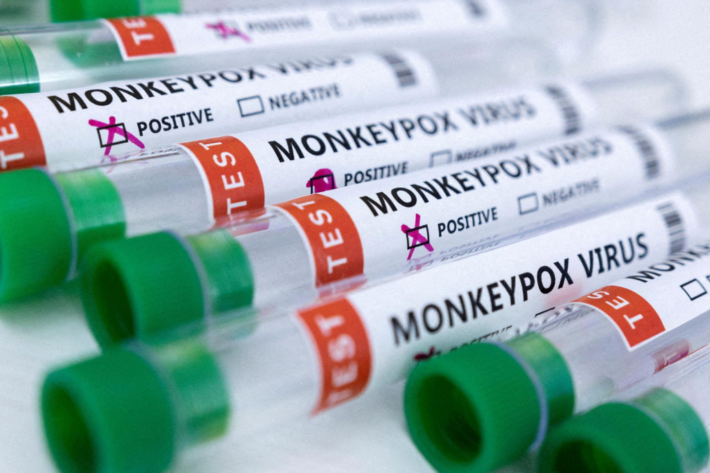 Skúmavky s nápisom vírus opičích kiahní. FOTO: Reuters