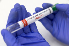 &lt;p&gt;Po dobratí lieku Paxlovid sa objavili opätovné prípady pozitívnych testov na koronavírus.&lt;/p&gt;