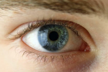 Medzi prvé príznaky syndrómu suchého oka patrí pocit cudzieho telesa v oku.