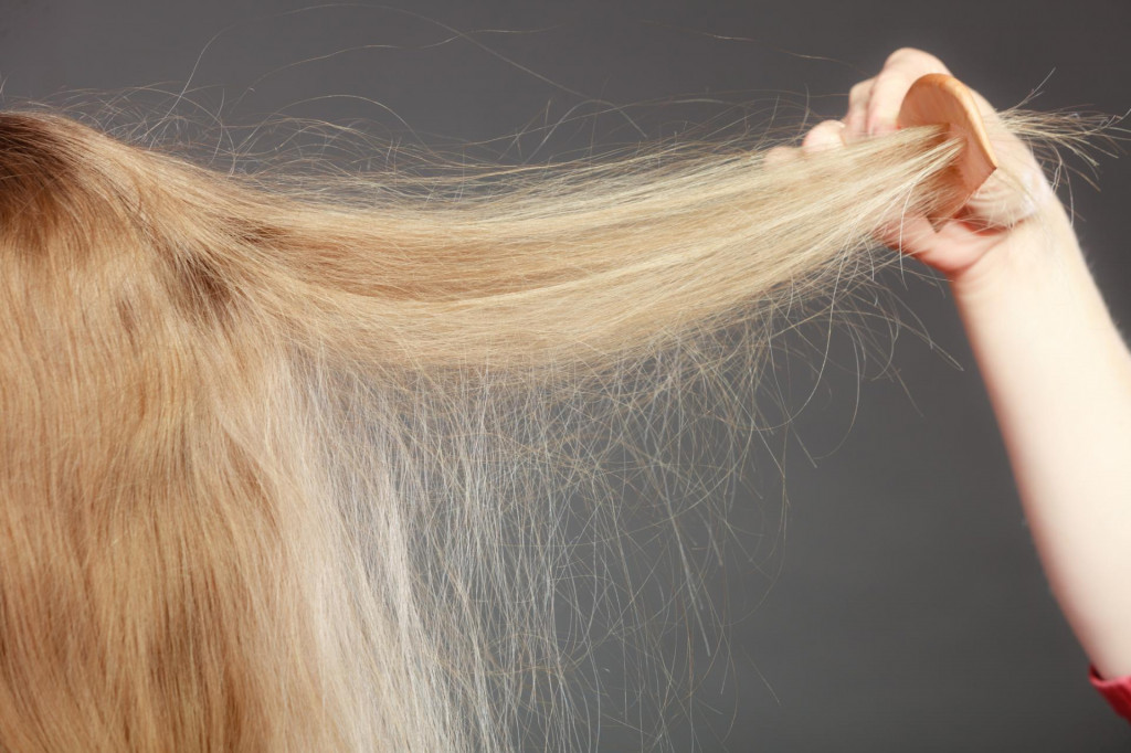 Takto jednoducho sa môžete zbaviť elektrizujúcich vlasov.