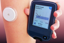 Senzor, ktorý využívame na okamžité meranie glukózy, je pomôcka na nezaplatenie.
