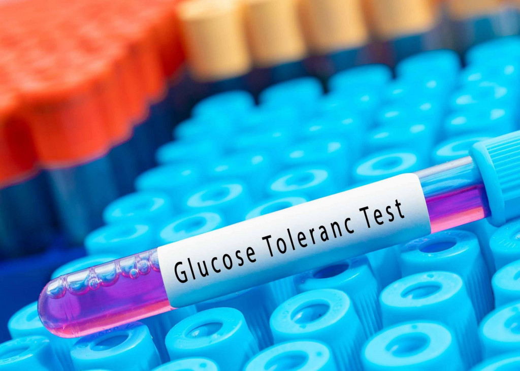 Test sa indikuje vo všetkých prípadoch, kde vzniká podozrenie na cukrovku.