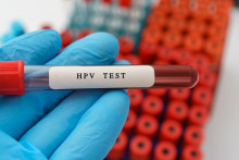 HPV vírus ohrozuje nie len ženy, ale aj mužov.