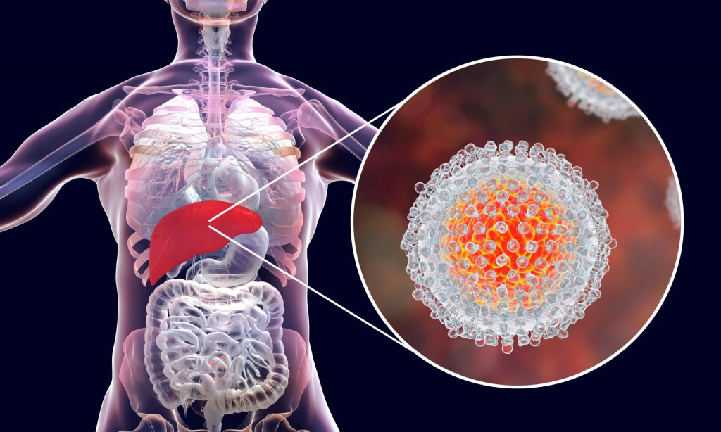 Hepatitída typu C, pečeň, ilustračná fotografia (Téma) SNÍMKA: Shutterstock