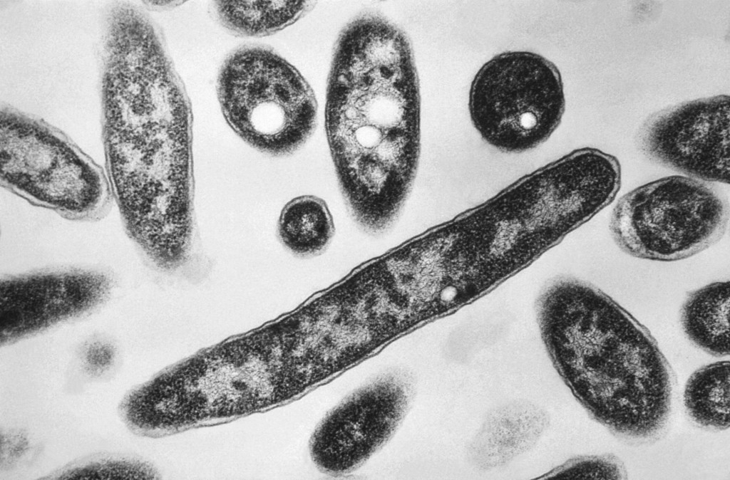 Na snímke z mikroskopu z roku 1978, ktorú sprístupnilo Centrum pre kontrolu a prevenciu chorôb, sú zobrazené baktérie Legionella pneumophila, zodpovedné za spôsobenie pľúcnej choroby známej ako legionárska choroba. FOTO: TASR/AP