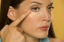 Na spadnuté očné viečka pomôže vajíčko či správna kozmetika.