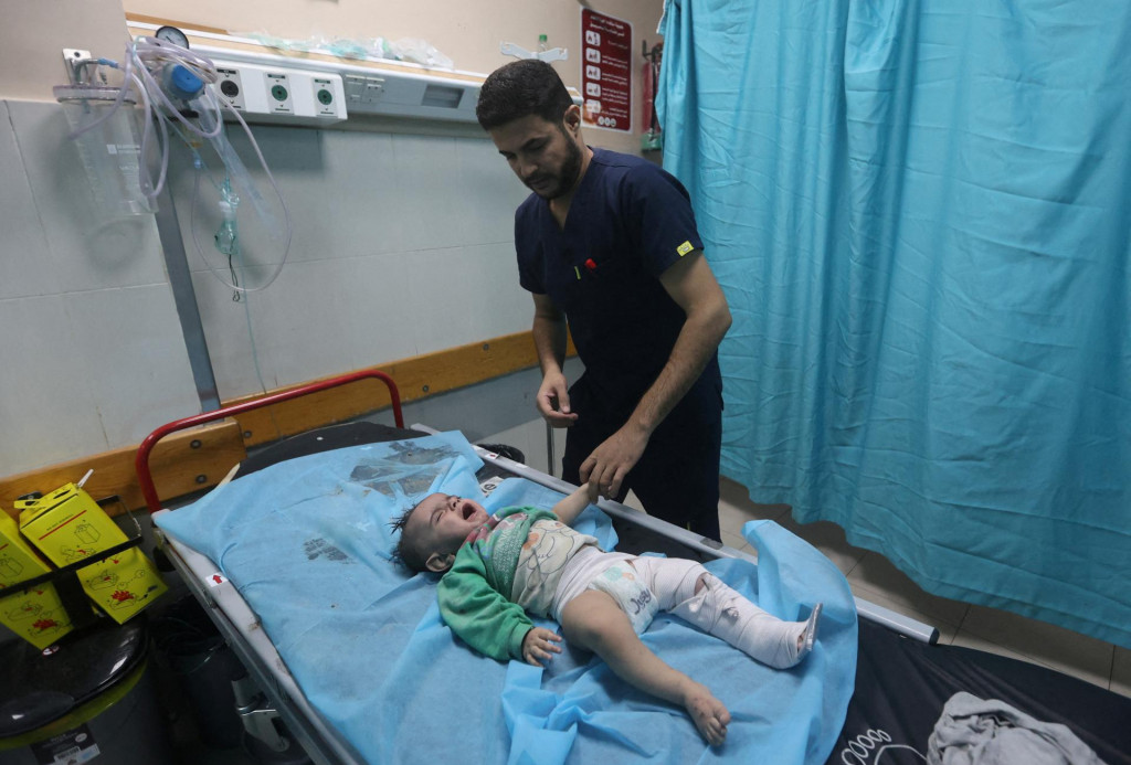 Palestínske dieťa, zranené pri izraelských útokoch, leží na lôžku a dostáva pozornosť médií v nemocnici. FOTO: Reuters