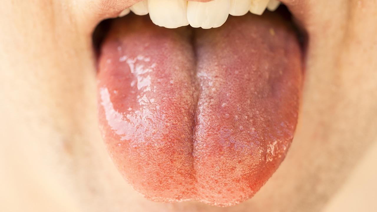 Najčastejšie príčiny, ktoré môžu spôsobiť zápach z úst. So zubnou hygienou to nemusí mať nič spoločné