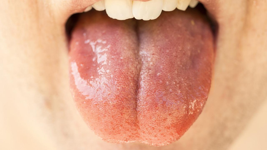 Aké sú najčastejšie dôvody, prečo sa z úst môže šíriť nepríjemný zápach, nájdete v galérii.