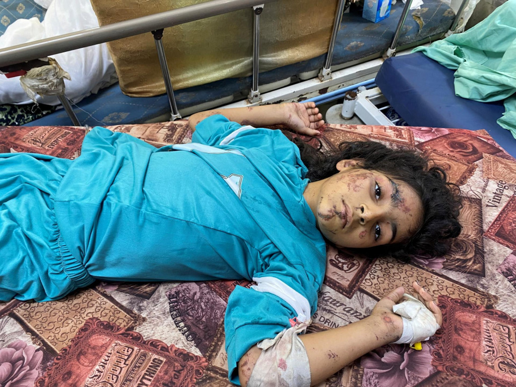 Dievča zranené pri izraelských útokoch leží v nemocnici Al Shifa. FOTO: Reuters