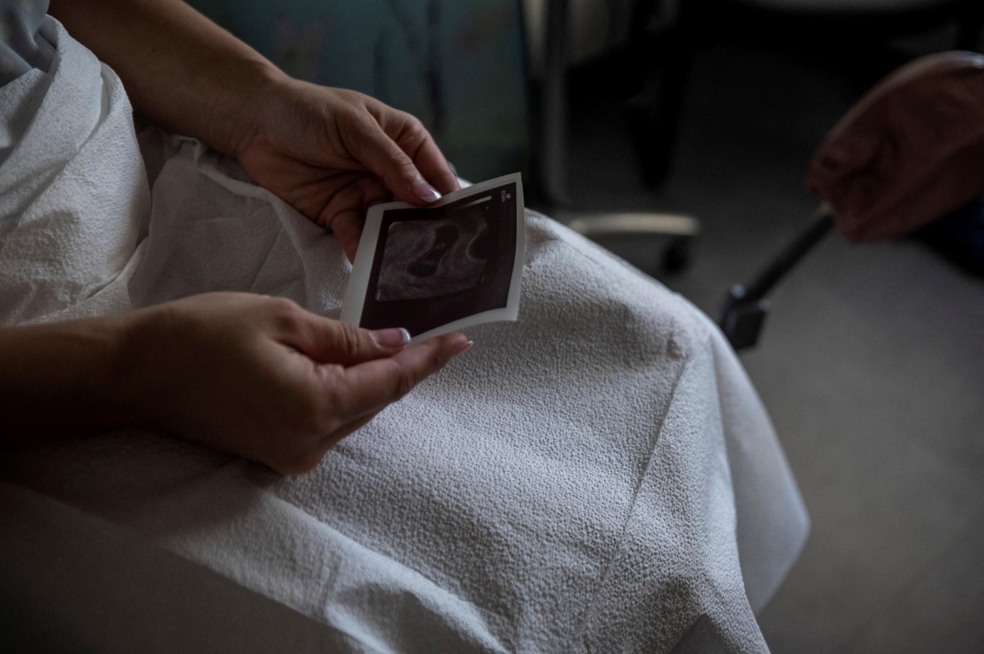 Rusko obmedzuje potraty. Parlament rokuje o ich zákaze na súkromných klinikách