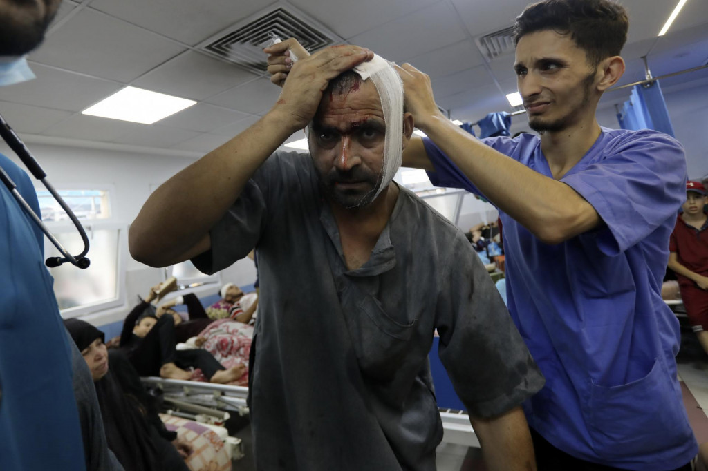 Na archívnej snímke z 5. novembra 2023 zranený Palestínčan pri izraelskom bombardovaní dostáva ošetrenie v nemocnici Šifá v Gaze. FOTO: TASR/AP