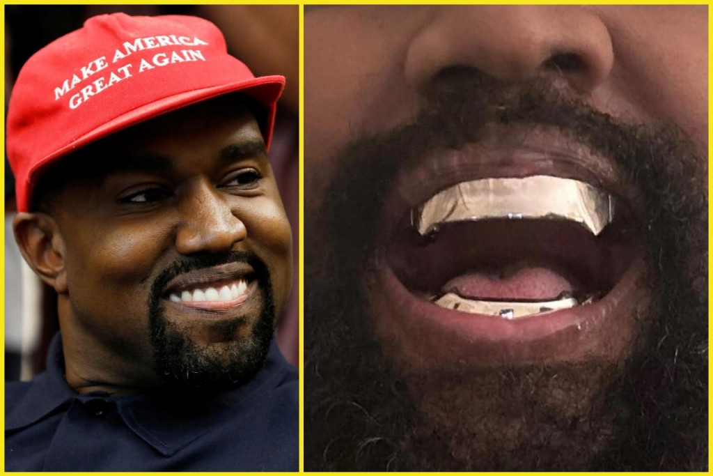 Kanye West si nechal urobiť nové zuby