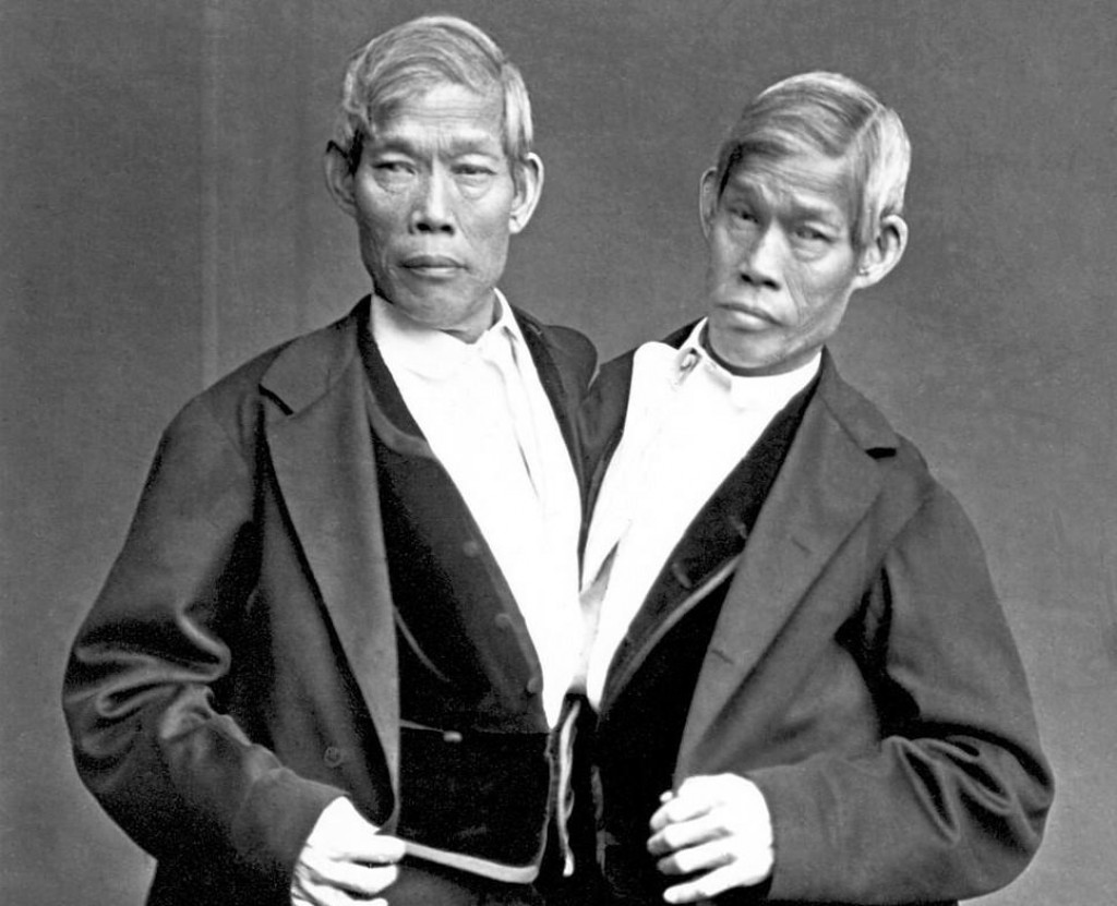 Príbeh „prvých“ siamských dvojčat.