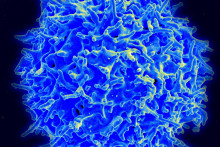 Ľudský T-lymfocyt FOTO: Niaid