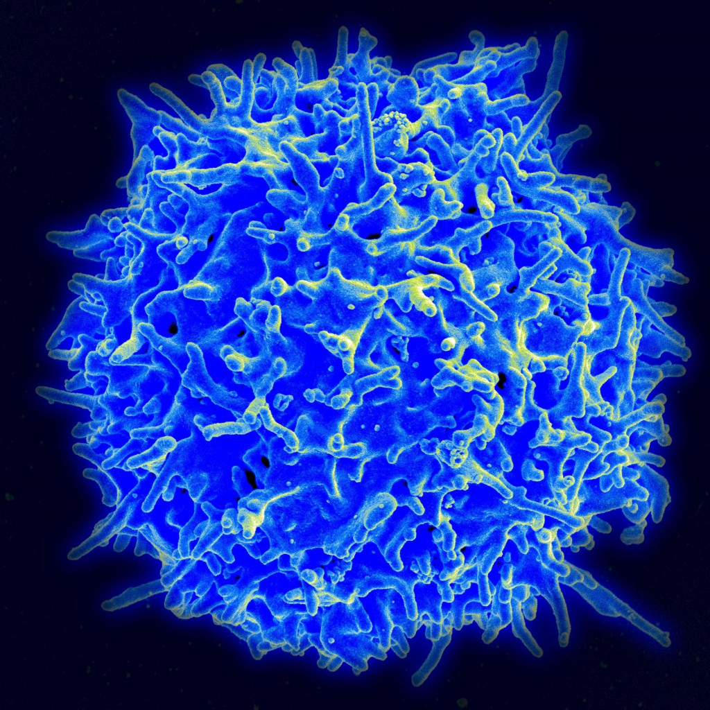 Ľudský T-lymfocyt FOTO: Niaid