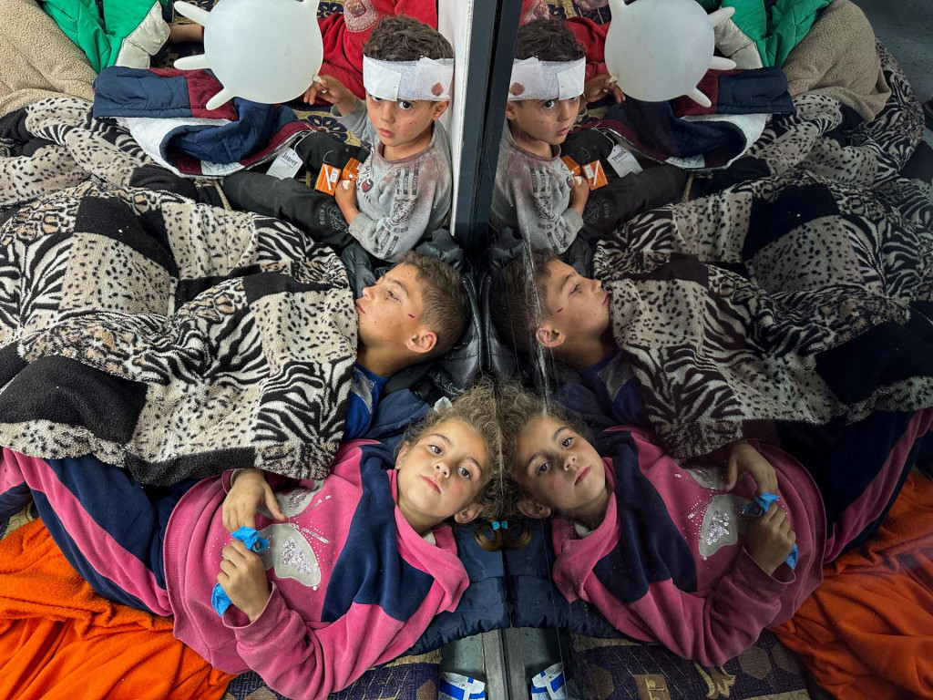 Palestínske deti zranené pri izraelskom údere odpočívajú počas liečby v nemocnici. FOTO: Reuters