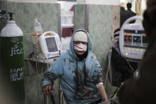 Palestínčanka, ktorá utrpela zranenia po izraelskom bombardovaní, sedí v nemocnici v meste Rafah v Pásme Gazy. FOTO: TASR/AP