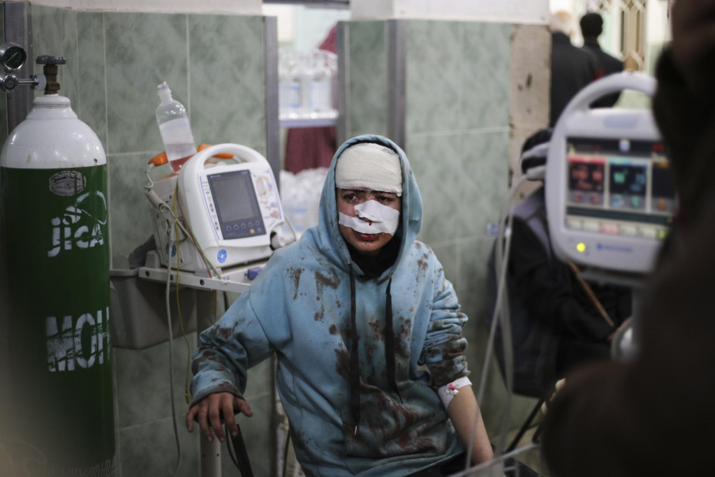 Palestínčanka, ktorá utrpela zranenia po izraelskom bombardovaní, sedí v nemocnici v meste Rafah v Pásme Gazy. FOTO: TASR/AP