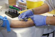 Krvný test by sa mohol vykonať na ľuďoch v skoršom veku.