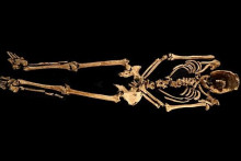 Kostra nevypovedala len o ukrižovaní, naznačila tiež, že muž trpel artritídou, chýbalo mu nemálo zubov. Kosti niesli stopy zápalu alebo infekcie. FOTO: Albion Archaeology