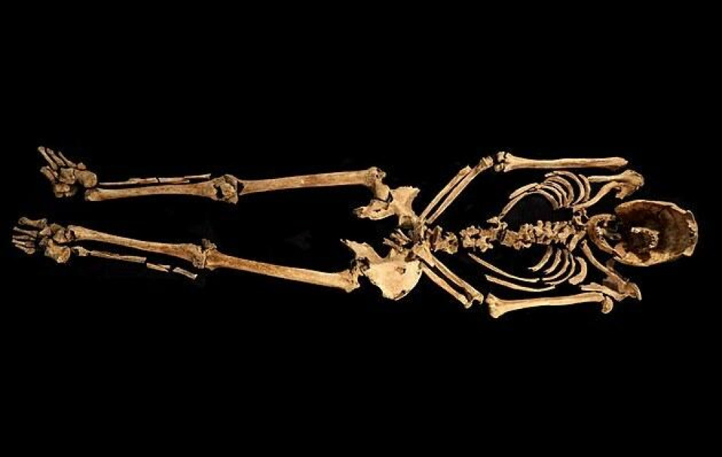 Kostra nevypovedala len o ukrižovaní, naznačila tiež, že muž trpel artritídou, chýbalo mu nemálo zubov. Kosti niesli stopy zápalu alebo infekcie. FOTO: Albion Archaeology