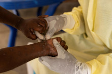 Laboratórna zdravotná sestra odoberie vzorku dieťaťu, u ktorého bolo vyhlásené podozrenie na Mpox. FOTO: Reuters