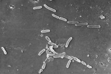 Na snímke z elektrónového mikroskopu sú zobrazené tyčinkovité baktérie Pseudomonas aeruginosa, kmeňa odolného voči antibiotikám.