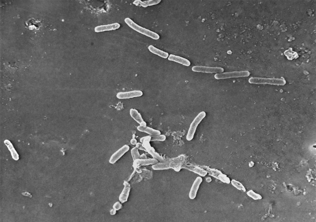 Na snímke z elektrónového mikroskopu sú zobrazené tyčinkovité baktérie Pseudomonas aeruginosa, kmeňa odolného voči antibiotikám.