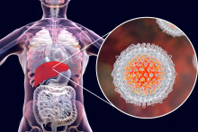 Včasná diagnostika a správna starostlivosť môžu významne zlepšiť prognózu pacientov.