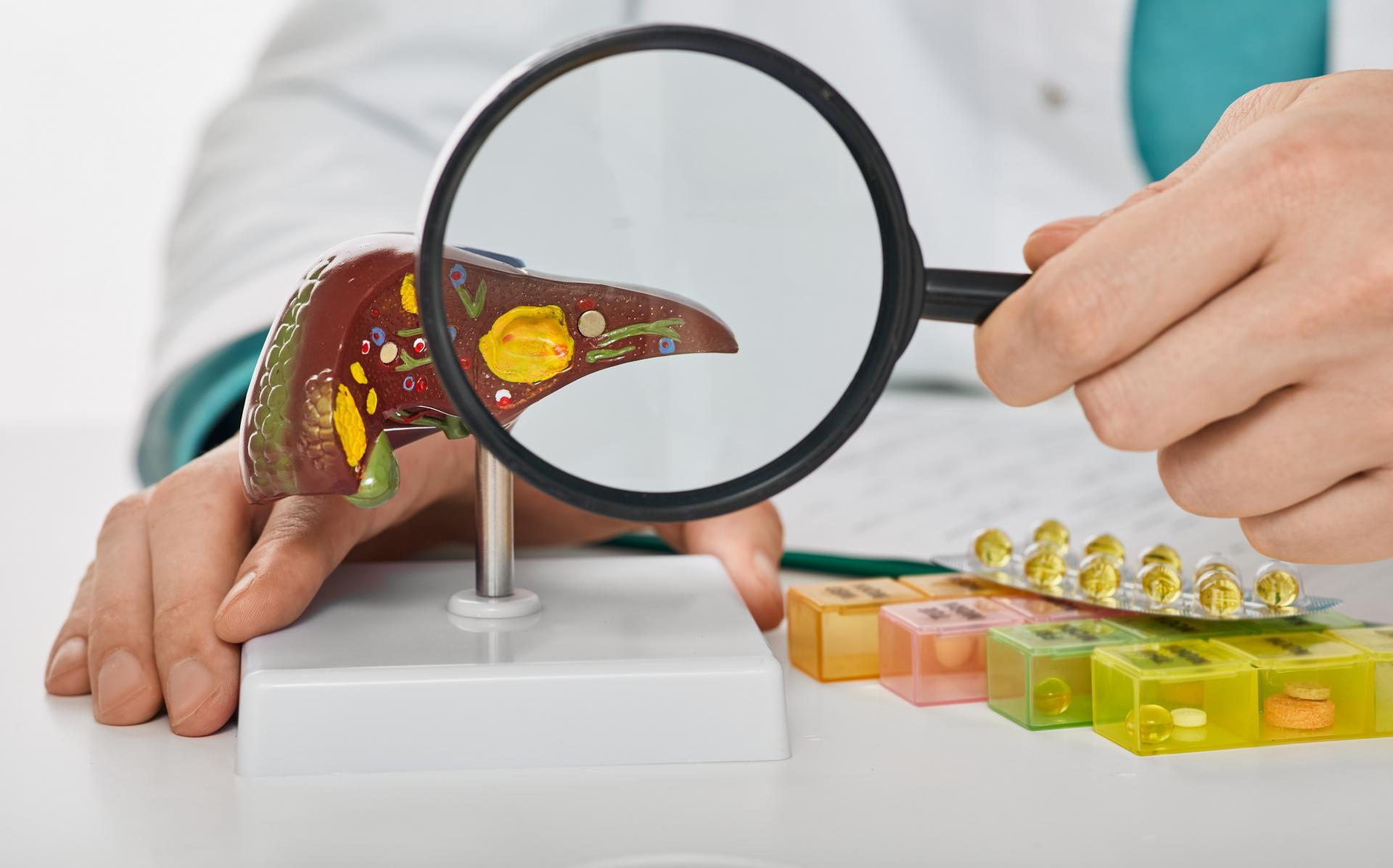 Cirhóza pečene patrí k tichým zabijakom. Kto je v ohrození? Odpovedá hepatológ MUDr. Daniel Ján Havaj