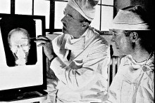 Lobotómiu po druhej svetovej vojne robil aj americký doktor Walter Freeman (na snímke vľavo, keď ukazuje kolegovi, kde urobí do lebky dieru).