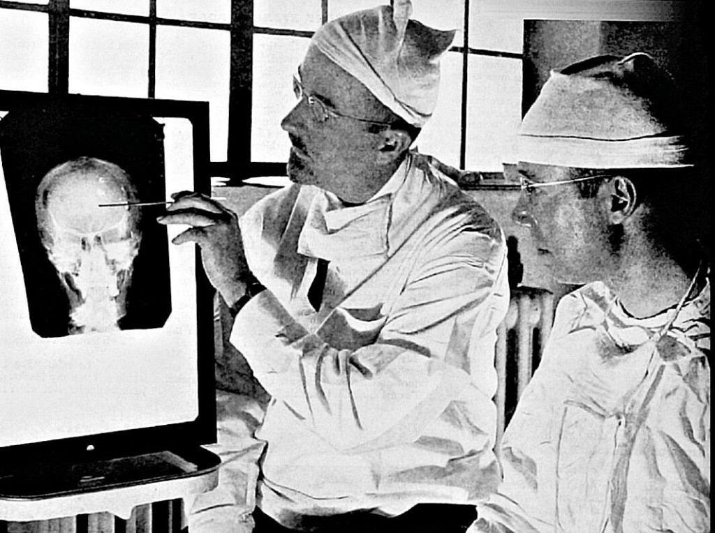 Lobotómiu po druhej svetovej vojne robil aj americký doktor Walter Freeman (na snímke vľavo, keď ukazuje kolegovi, kde urobí do lebky dieru).