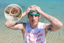 Influencer Expl0 doprial mame omladzujúcu operáciu.